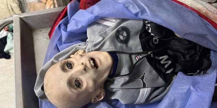 فلسطين: استشهاد 31 شخصا على الأقل جراء سوء التغذية والجفاف في غزة